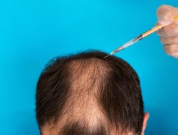 Stevia Berpotensi Sembuhkan Kebotakan dan Berfungsi Sebagai Pemanis Alami