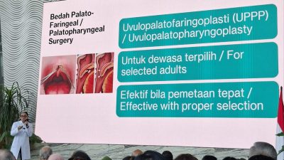 Mendengkur Bukan Tandanya Tidur Nyenyak menurut Dokter