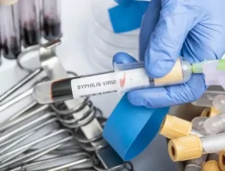 Tanda Sifilis Berdasarkan Tahapan, Waspadai Sejak Dini