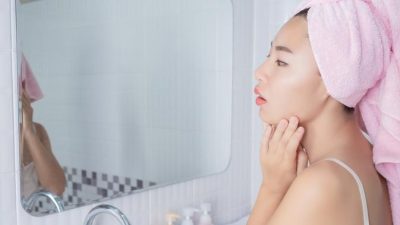 Penyebab Jerawat Hormonal dan Cara Mengatasi Tanpa Menyisakan Bekas