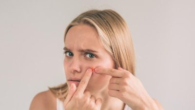 Kenali 13 Jenis Jerawat dan Cara Menanganinya untuk Mengatasi Masalah Kulit Anda