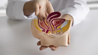 5 Pola Makan dan Gaya Hidup Penyebab Wasir atau Ambeien Menurut Dokter