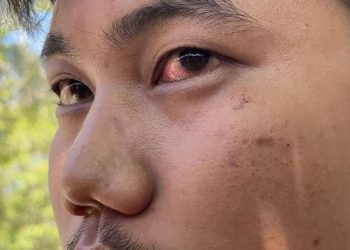 Insiden Jalan Raya, Direskrimum Polda Sumbar Diduga Lakukan Penganiayaan Terhadap Pengendara