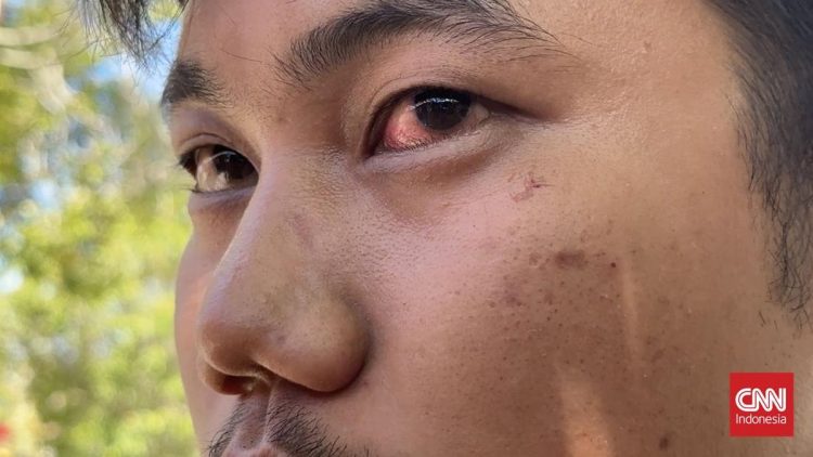 Insiden Jalan Raya, Direskrimum Polda Sumbar Diduga Lakukan Penganiayaan Terhadap Pengendara