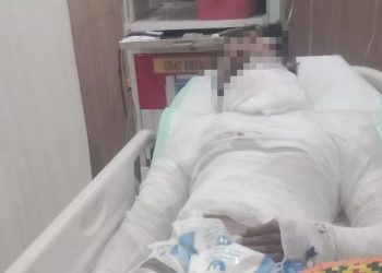 Sopir Truk Bali yang Terbakar oleh Bosnya Meninggal Dunia setelah Seminggu Kritis